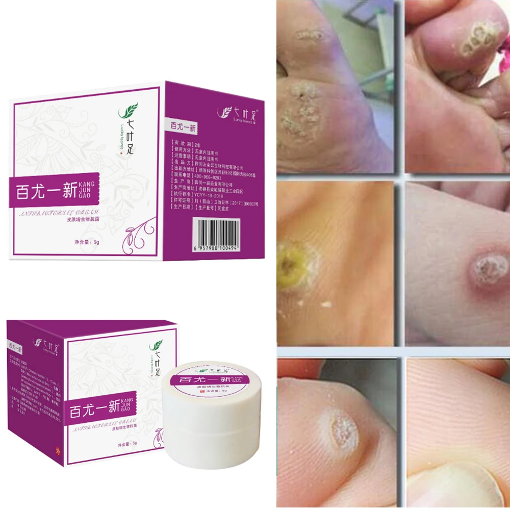 

5g Mole & Skin Tag Repair Solution Painless Mole Skin Dark Spot Repair Face Wart Tag Freckle Repair Cream Oil Dropshipping D105