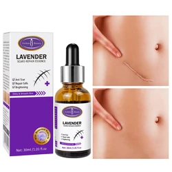 Lavender Repair Lotion Imprint Fade Postpartum Skin Repair Treatment Scar Nourish Whitening Moisturizing Care Body Serum 30ml