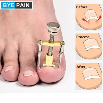 

1Pcs BYEPAIN Adomaner Ingrown Toenails Fixer Orthotics Toe Nail Recover Correction Tool Nail Care Device Manicure Pedicure Set