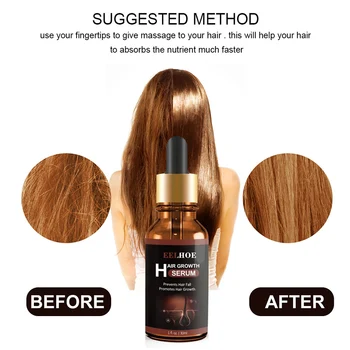 

Nourishing Styling Moisturizing Natural Hairline Against Loss Essential Oil Healthy Hair Growth Serum Effective Damaged Repair