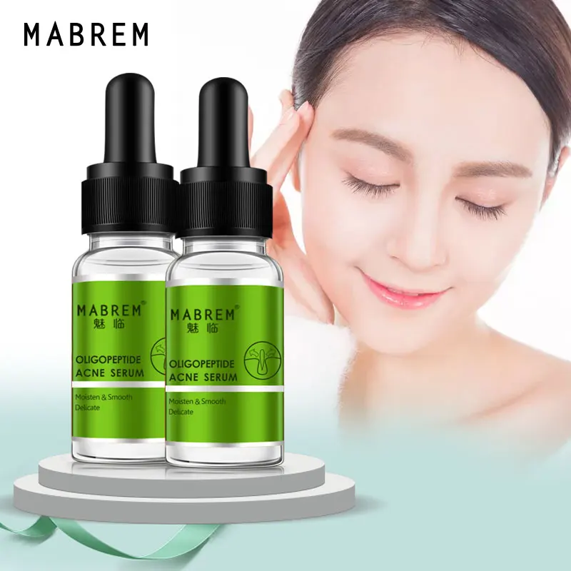 brightening serum for acne scars
