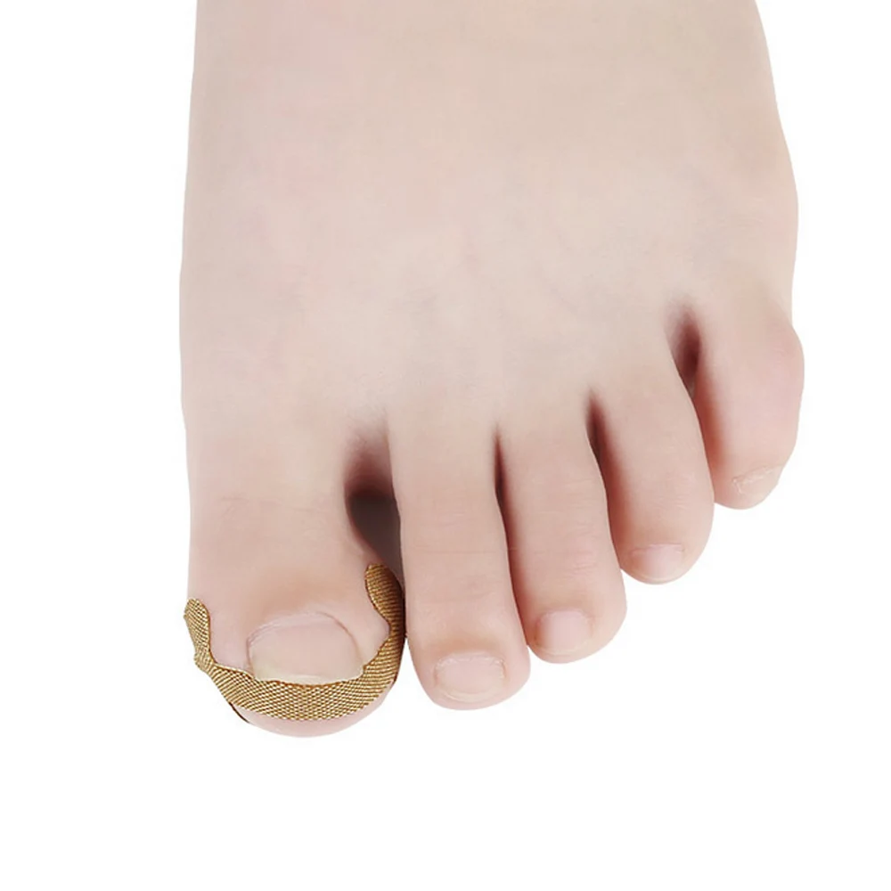 8PCS Ingrown Toenail Nail Correction Stickers Paronychia Treatment Recover Corrector Fingernail Nails ingrown Correction Patches
