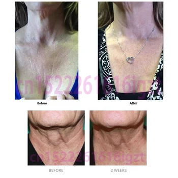 Xhekpon Crema Face and Neck Cream 40ml Neckline Cream Wrinkle Smooth Anti aging Whitening