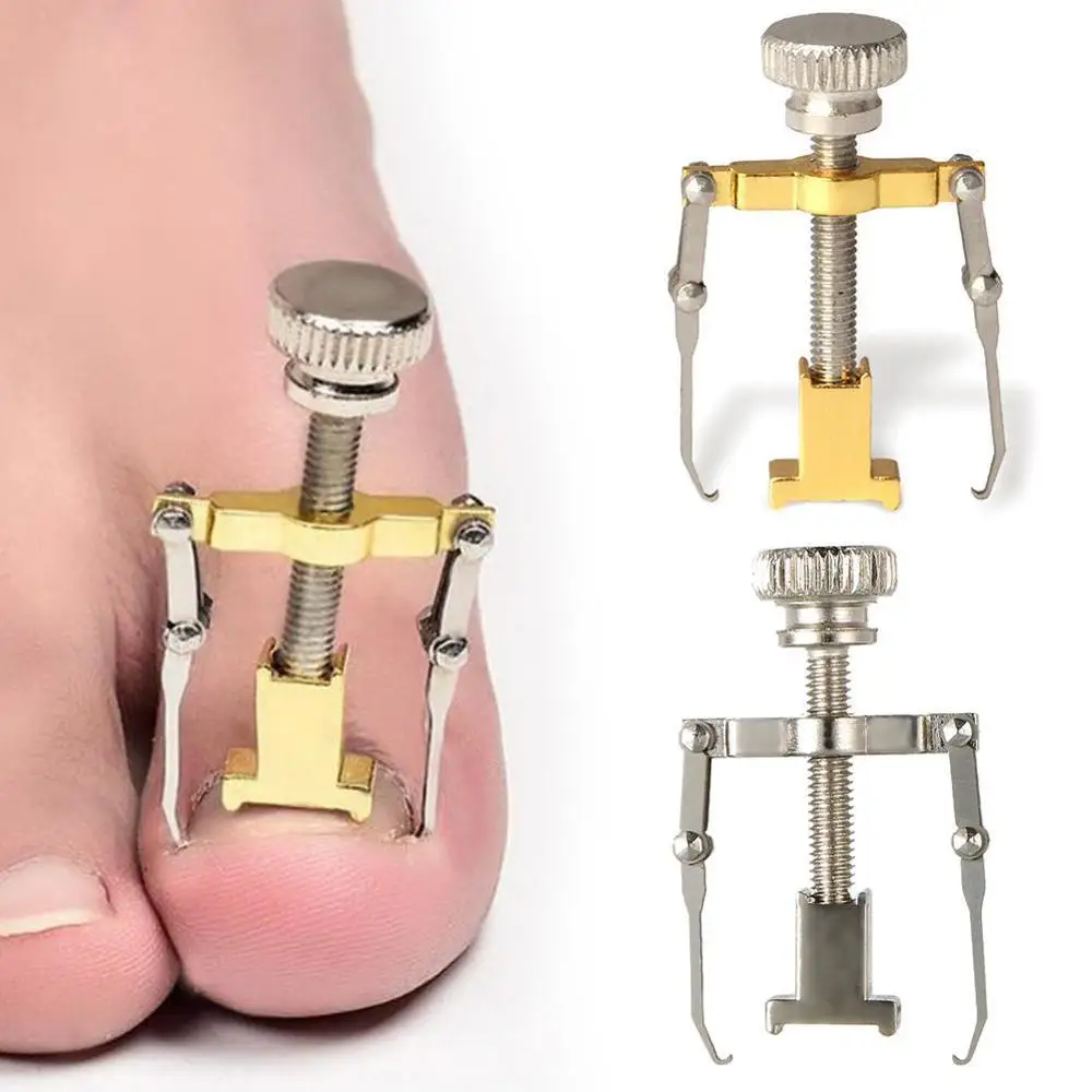 1PC Ingrown Toe Nail Recover Tool Pedicure Toenail Fixer Pedicure Foot Nail Care Ingrowing Nail Onyxis Bunion Corrector for Toes 1PC Ingrown Toe Nail Recover Tool Pedicure Toenail Fixer Pedicure Foot Nail Care Ingrowing Nail Onyxis Bunion Corrector for Toes