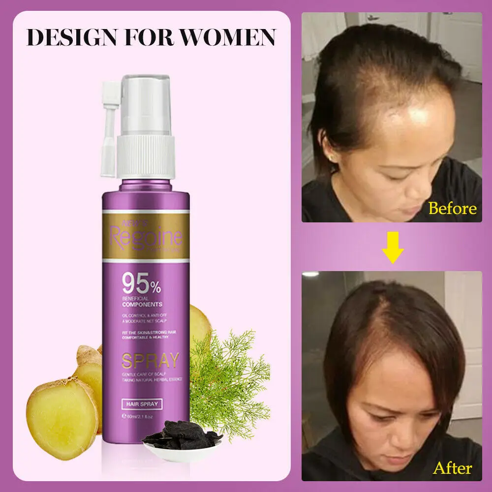 55 мл масло для лечения роста волос, быстрое густое натуральное средство против выпадения волос, эссенция, восстанавливающая рост, для женщин, уход за волосами, спрей-сыворотка