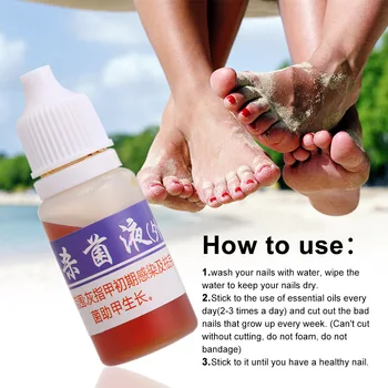 

Fungal Nail Treatment Feet Care Essence Nail Foot Whitening Toe Nail Fungus Removal Gel Anti Infection Paronychia Onychomycosis