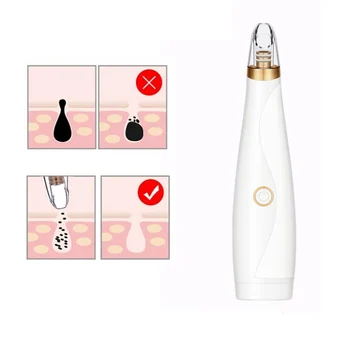 

Face Cleaning Cleaner Effective ABS Remove Fast Blackhead Removal Equipment Cosmetic Instrument White Wholesale