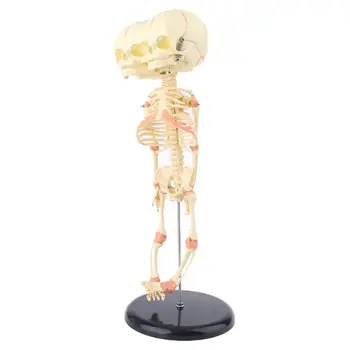 

Human Baby Deformed Head Skull Research Model Skeleton Anatomical Brain Anatomy Teaching Study Display