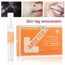 1 шт. метка на коже средство для удаления бородавок для ухода за кожей средство для удаления мозолей подошвенные бородавки мазь Уход за ногами медицинское штукатурное средство по уходу за ногами