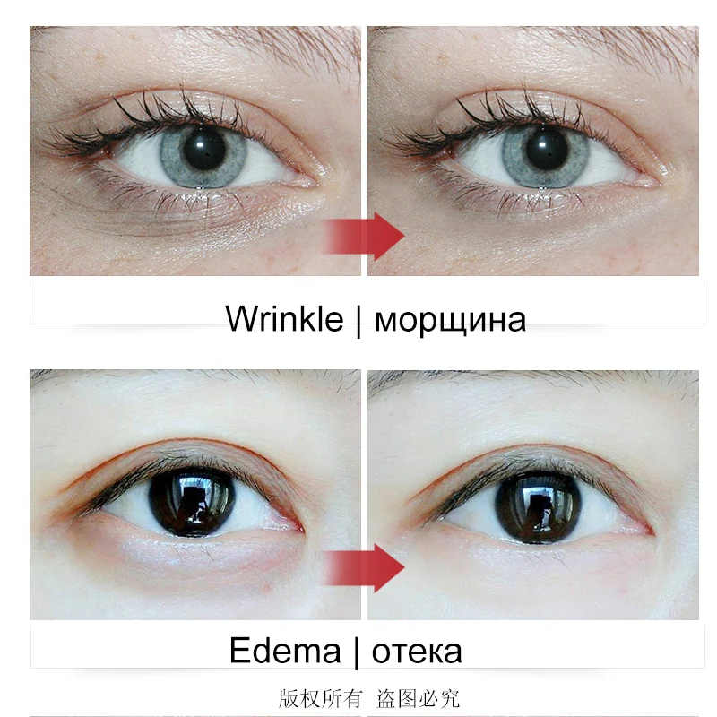 Günstig [Normalen lieferung] Fonce Snake Venom Essenz Augen Maske 60 Stück Für Verblasst Augenringe Auge Taschen Straffende Falten eye Patches