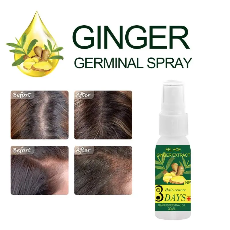 Esencia de suero Germinal de jengibre, tratamiento para pérdida de aceite, crecimiento del cabello, prevención de pérdida de cabello, Alopecia líquida dañada, reparación del cabello, TSLM