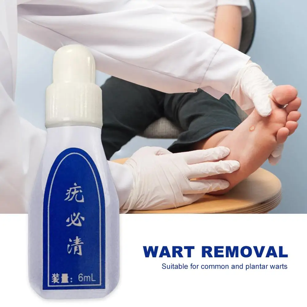 

6ml Skin Tags Removing Genital Wart Treatment Papillomas Removal of Warts Liquid From Against Moles Anti Verruca Remedy