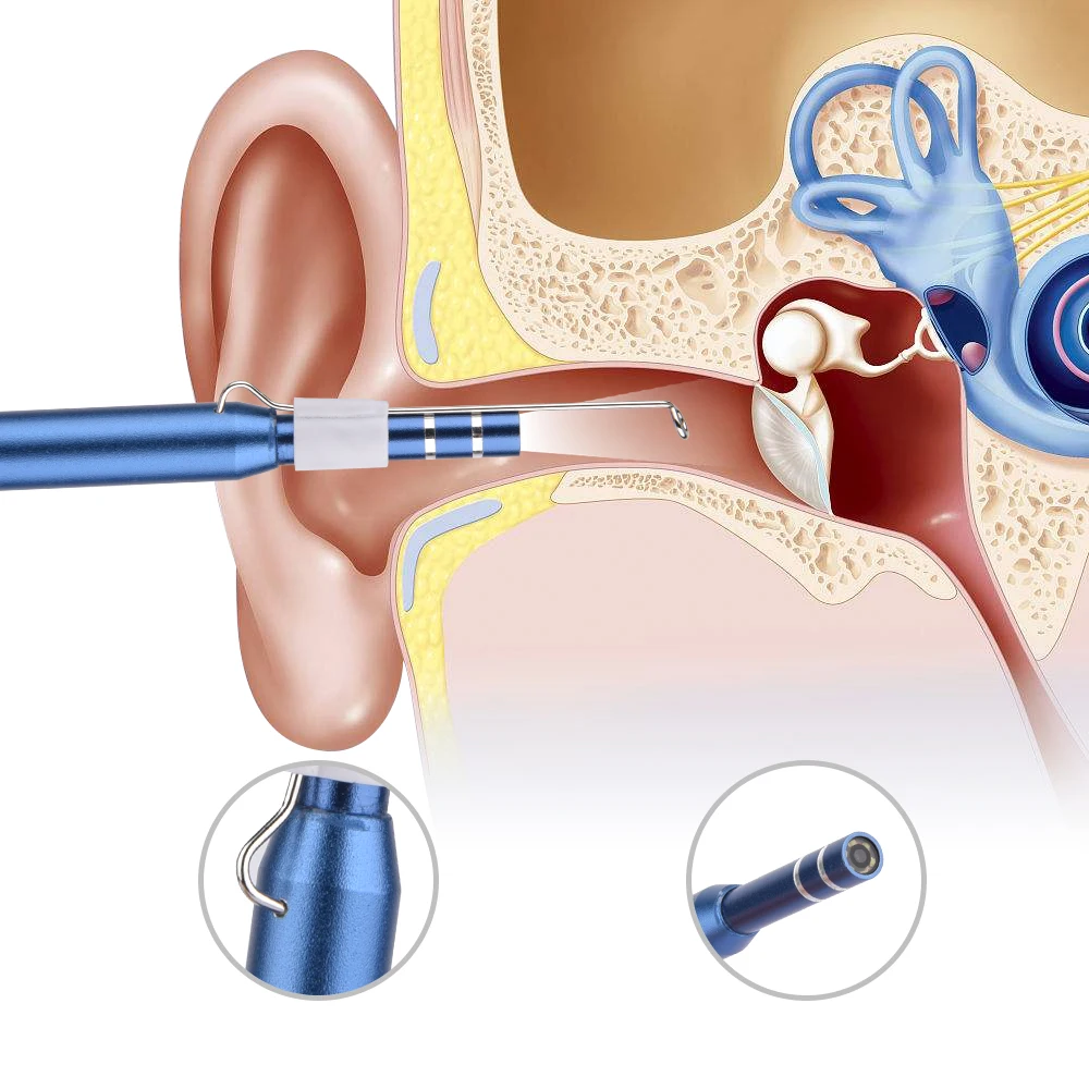 Cámara endoscópica para limpieza de oídos, endoscopio para teléfono móvil Android, USB C, Mini cámara endoscópica, otoscopio médico, PC Digital - Imagen 4