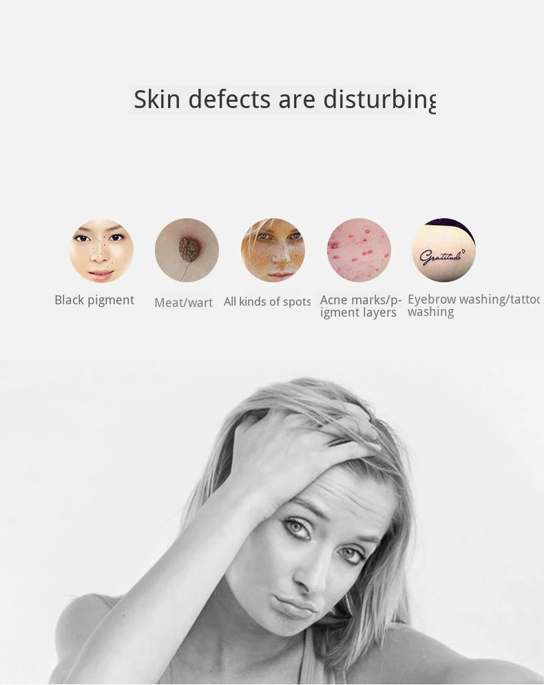Removedor de Cravo Bateria Recarregável Portátil Handheld Laser Picosegundo Caneta Ponto Mole Clareamento Sarda Remoção Melanina 3 Beleza e saúde