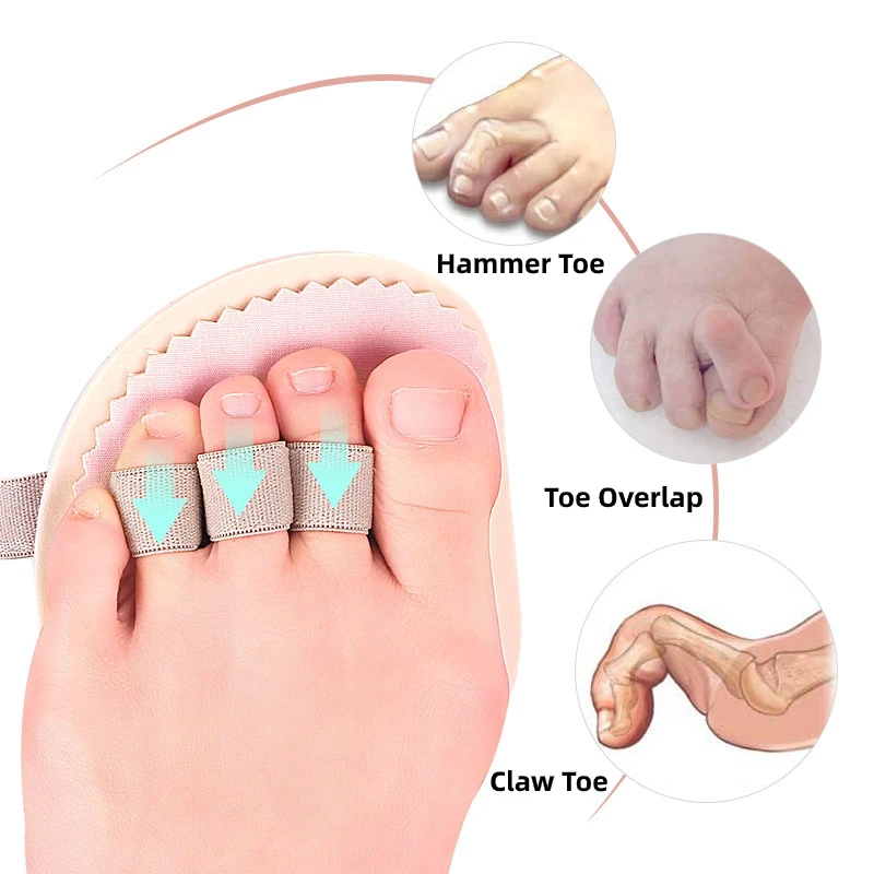 toe separators,toe corrector,toe spreader,finger toe separator,toe protectors,ingrown toenail corrector 1Piece Unisex Hammer Toe Cushions Protector Separator Support Pads