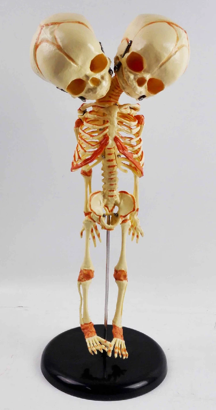 Nouveau Ne Humain Bebe A Double Tete Anatomie Squelette Cerveau Modele D Education D Anatomie Modele D Exposition Aliexpress