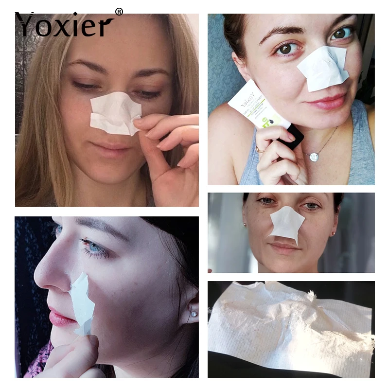 Yoxier Remove Blackhead Acne Nose Peeling Fabric Mask Skin Care Pore Strip Black Shill For Acne 1 Yoxier Remove Blackhead Acne Nose Peeling Fabric Mask Skin Care Pore Strip Black Shill For Acne 5