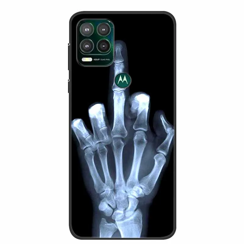 Cute Cats Shockproof Soft TPU Silicone Case - Durable Protection