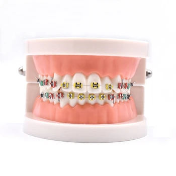 

1 Pcs Orthodontic Treatment Model with Ortho Metal Ceramic Bracket Arch Wire Buccal Tube Ligature Ties