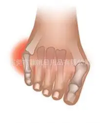 Силикагель маленький носок Bunion защитный чехол для детей Hallux Varus коррекционный носок боль Ху ли Тао износостойкость