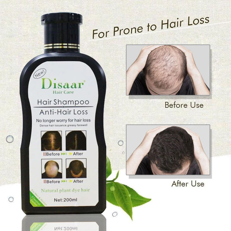 200ml Disaar Professional Anti Hair Loss Shampoo Preventing Hair Loss Chinese Hair Growth Product Hair Treatment For Men Women Aliexpress