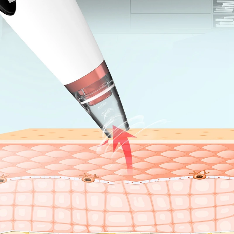 6 в 1 Электрический пор для лица вакуумный отсос для угрей удаления машина для удаления акне экстрактор для очищения пор лица средство для удаления омертвевшей кожи