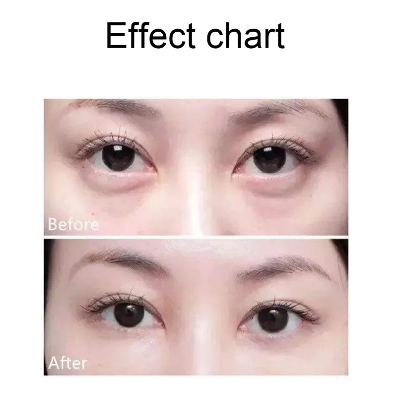 NEW Eye Mask Anti-Aging Collagen Eye Patches Moisturizing Reducing Dark Circles under Eyes Pads@ME88