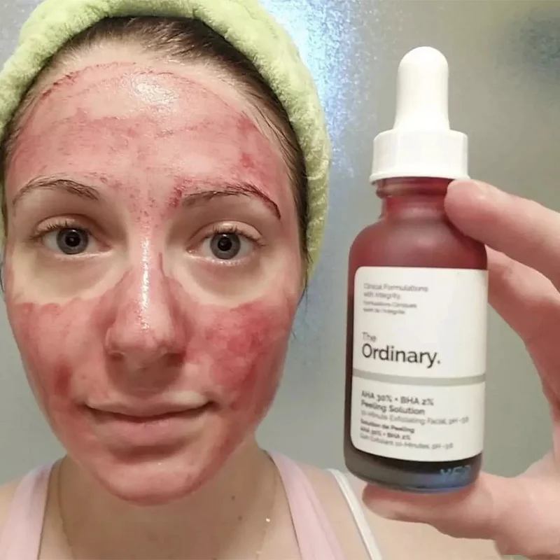 Средство для снятия акне и увлажнения лица с гиалуроновой кислотой 30 мл | Красота