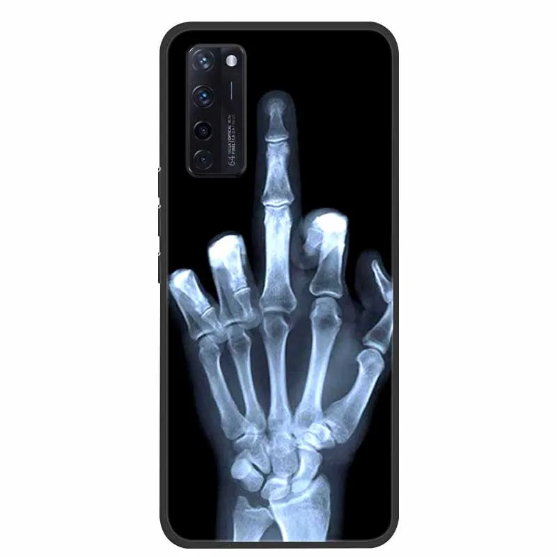 Luxury Silicone TPU Soft Shockproof Cartoon Phone Case Cover