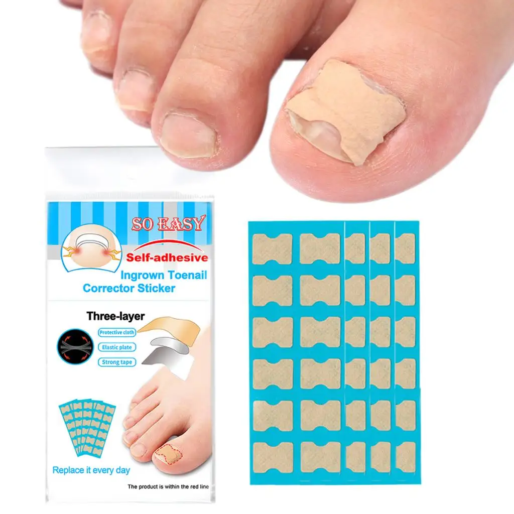 Ingrown Toenail Corrector Sticker Toe Nail Treatment Pedicure Foot Care Stickers Pedicure Tool Toenail Patch Glue Free