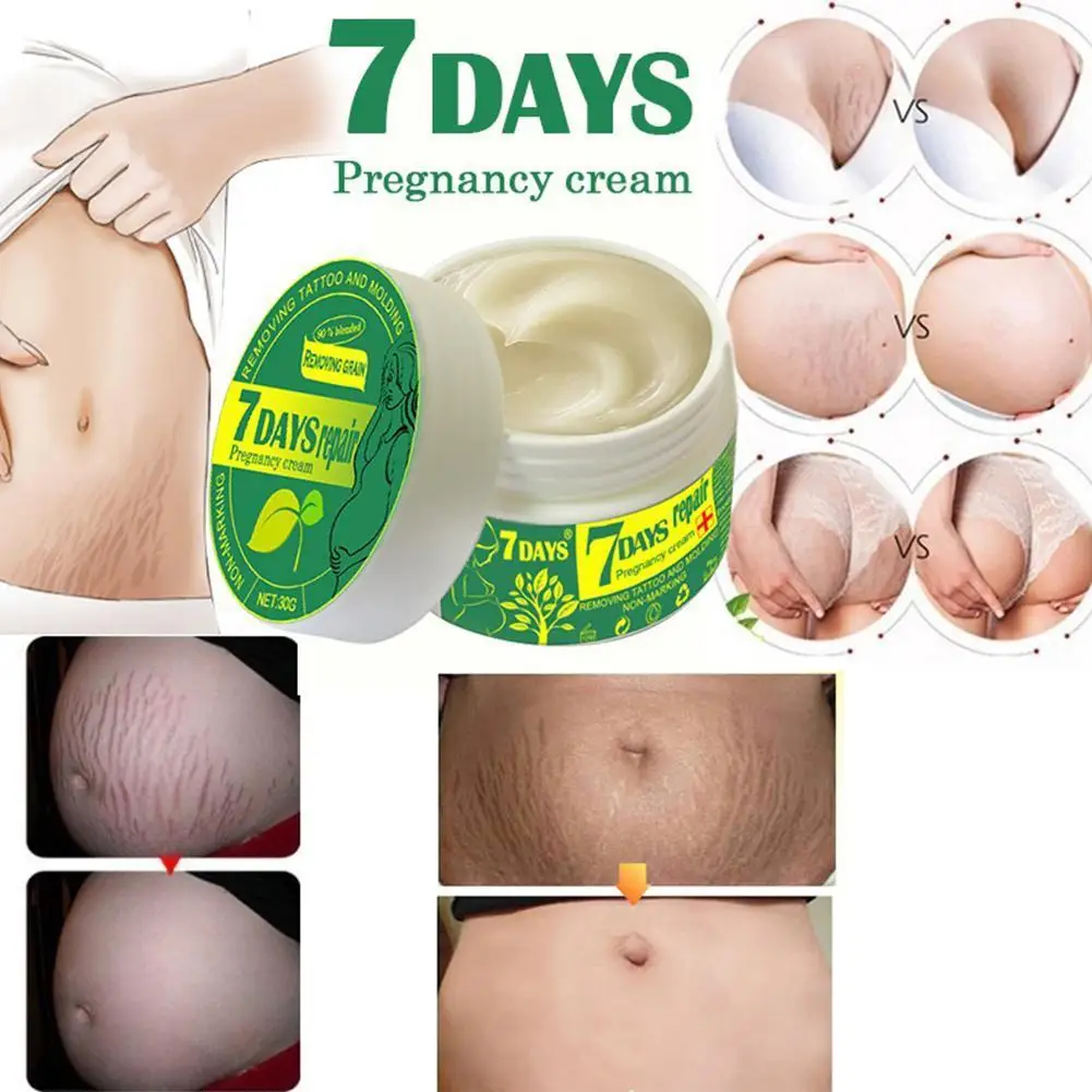 Removal Stretch Mark Cream Repair Abdomen Scar Acne Cell Regeneration Beauty Skin Promote Cosmetics L3D6 |