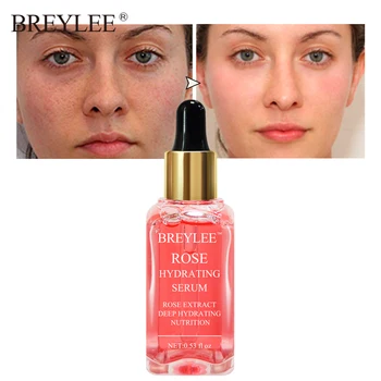 

BREYLEE 100% Natural Rose Moisturizing Nourishing Serum Deep Hydrating Face Soothing Whitening Anti-aging Wrinkle Skin Care 15ML