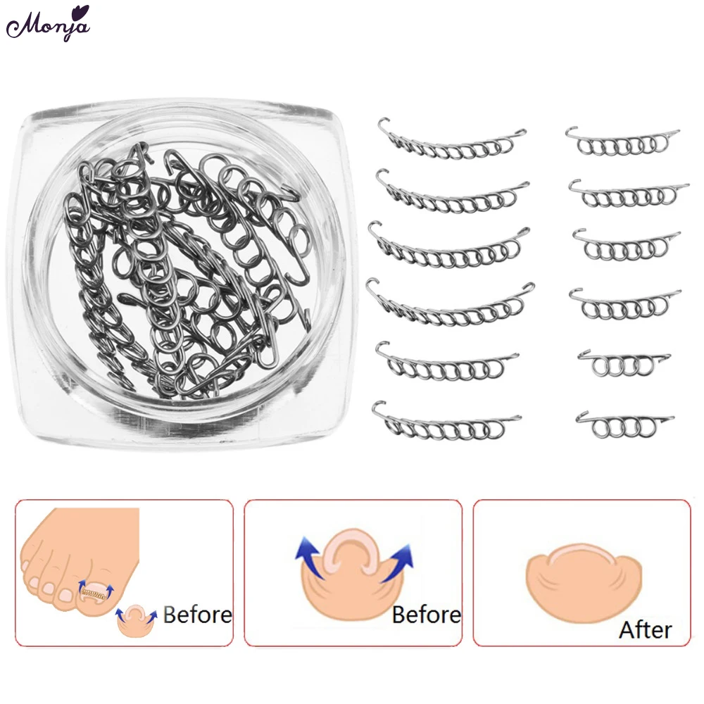 Monja 12pcs Ingrown Toe Nail Correction Wire Fixer Pedicure Paronychia Recover Toenails Corrector Foot Care Tool