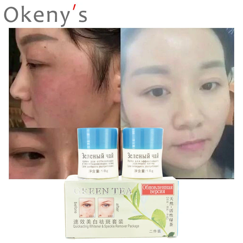 strong acne spot treatment
