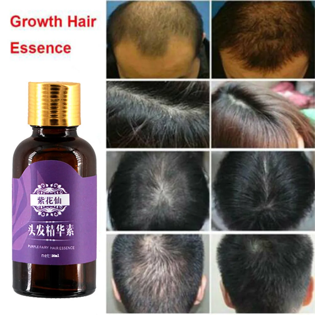 

Hair Care Essence Prevention Hair Loss Effective Growth Nourishes Oil Control Fast Hair Growth Natural Hair Loss Treatment Hair