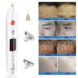Professional Freckle Wrinkle Mole Tattoo Removal Pen Powerful Plug-in Scar Tattoo Remove Machine Electric Magic Ionic Plasma Pen