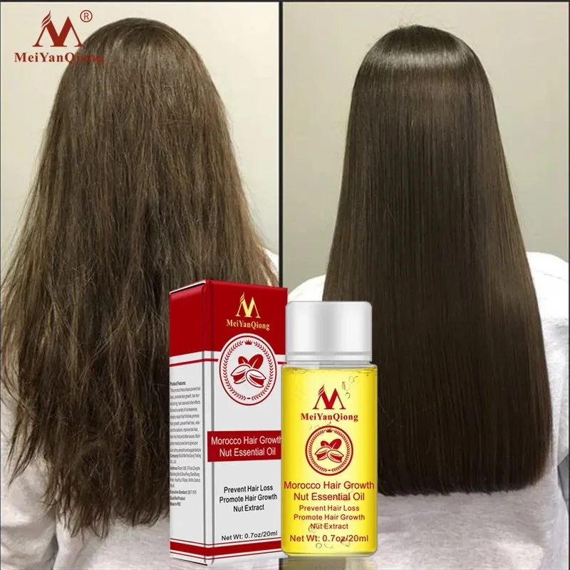Crescita rapida Potenti prodotti essenziali Olio essenziale Trattamento liquido Prevenzione della perdita Cura dei capelli_voghion.com