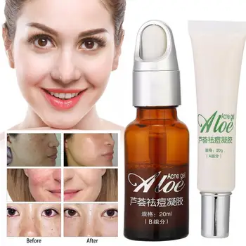 

Professional Beauty Skin Care Cream Aloe Vera Pimple Removal Gel Fade Pimple Mark Serum Skin Care Tool (A Type 20ml+B Type 20ml)