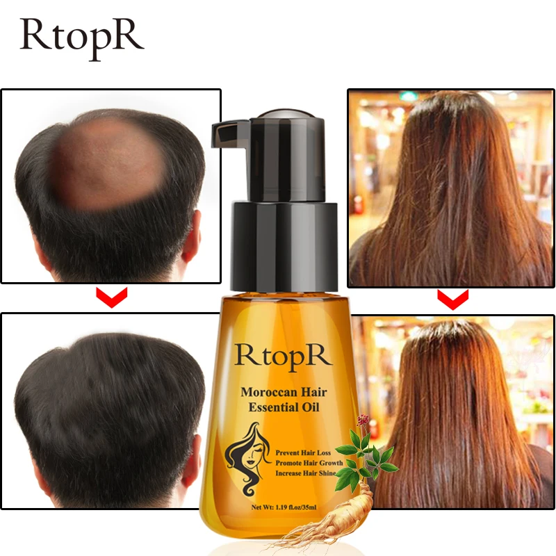 Rtopr 35ml Liquid Fast Hair Growth Essential Oil Prevent Hair Loss Product Women Men Beauty Hair 3