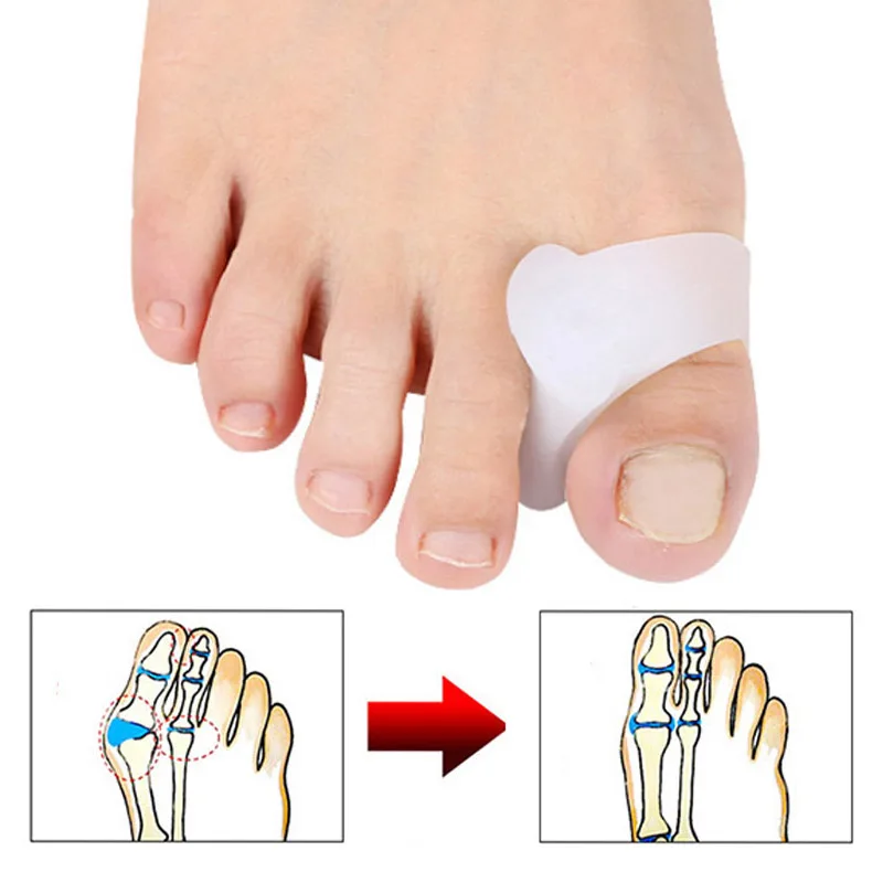 6Pcs Big Toe Separator Bone Corrector Straightener Silicone Gel Foot Fingers Protector Bunion Adjuster Feet Pedicure Tool D2224