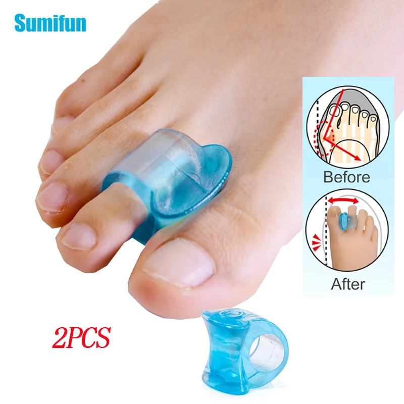 2pcs Blue Gel Toe Separator Foot Care Tool Silicone Toe Bunion Straightener Valgus Hallux Bunion Protector Corrector Alignment