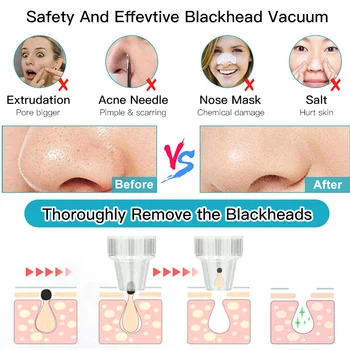 

Electric Acne Remover Blackhead Remover Face Deep Nose Cleaner Face Pore Vacuum Skin Care USB Rechargeable Suction Tools Facial