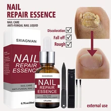 

20ml ​Fungus Nail Repair Essence Nail Treatment for Cracked Rough Fungal Nails Strengthen Damaged Nails of Fingernails Toenails