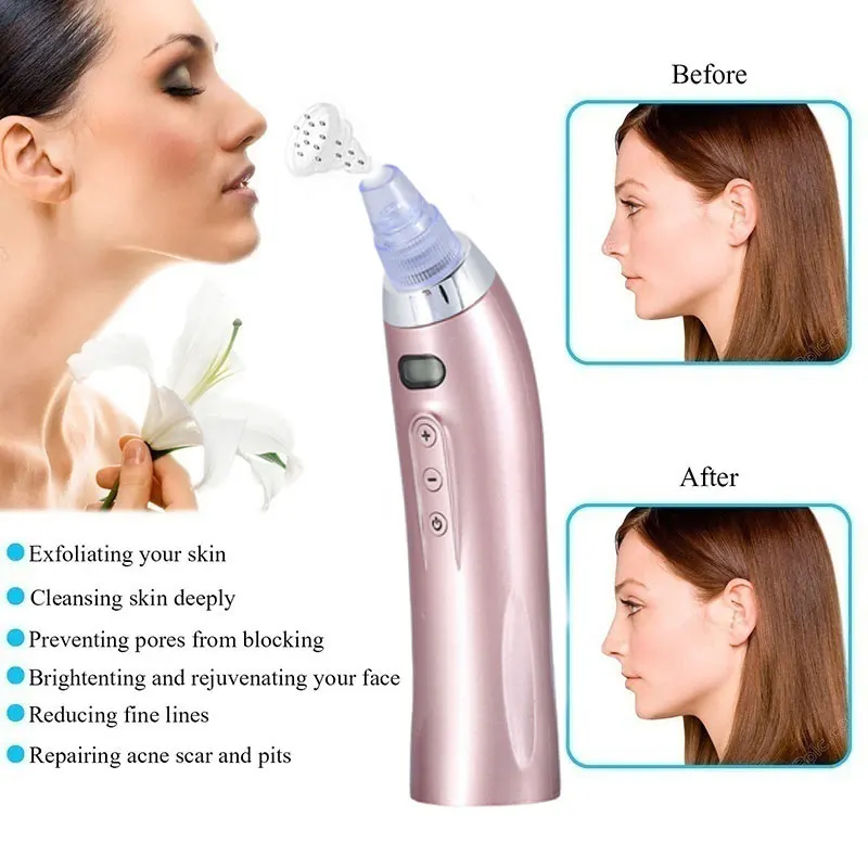 Electric Acne Remover Blackhead Remover Pore Vacuum Facial Acne Suction Vaccumm Removal Deep Pore Acne Black Spots Pore Cleaner