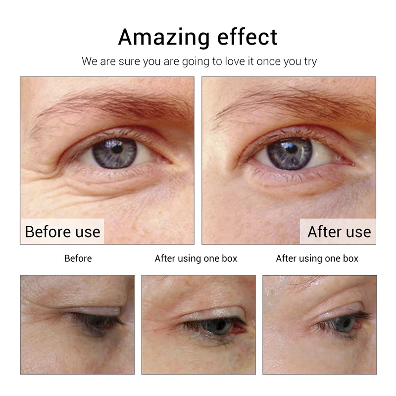 Fonce-Eye-Cream-Anti-wrinkle-Cream-Firming-Eye-Mask-Remove-Dark-Circles-treatment-Anti-Puffiness-Moisture