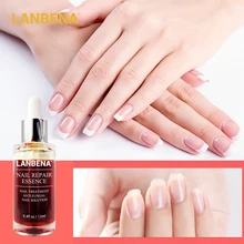 LANBENA, сыворотка для восстановления ногтей, лечение грибковых ногтей, эссенция для удаления онихомикоза, для пальцев ног, Питательная, осветляющая, уход за кожей