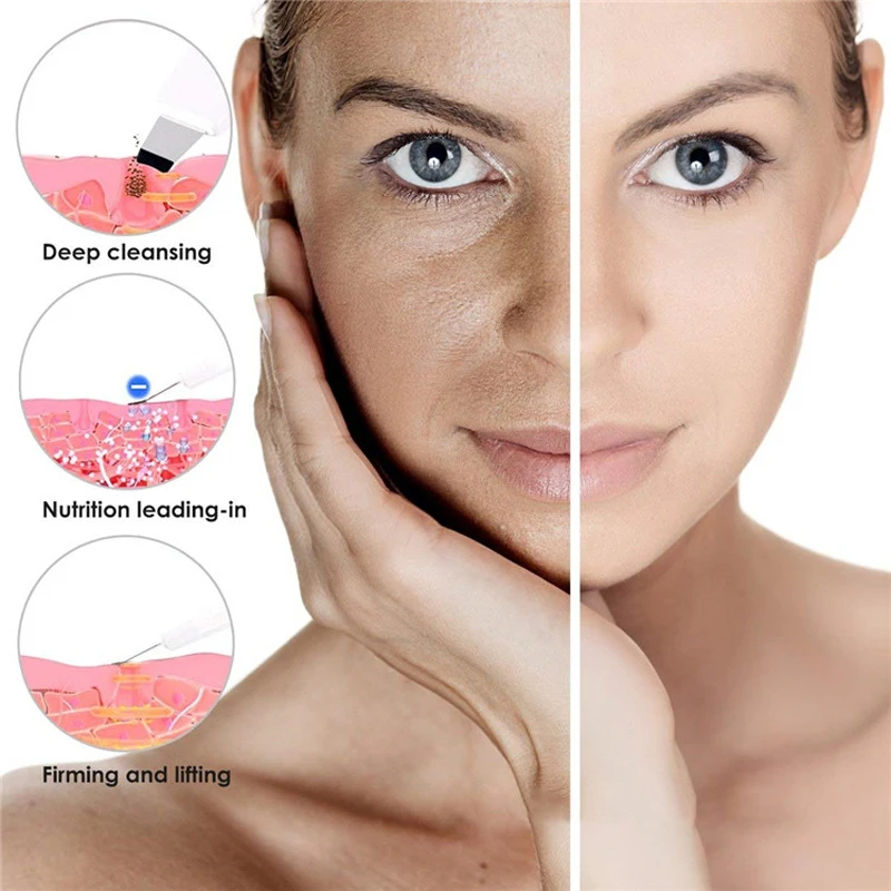 Ultrasonic Face Peel Deep Face Cleaning Machine Skin Scrubber Remove Dirt Blackhead Reduce Wrinkles and Spots Facial Lifting