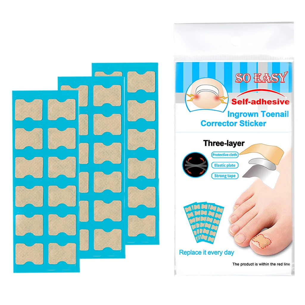 Toenail Correction Stickers Patch Toe Nail Treatment Corrector | Красота и здоровье