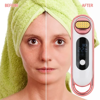 

Young RF Instrument Massager Face Lift Tape Anti Aging USB Charging White Skin Wrinkl Electric Slimming Fat Burning