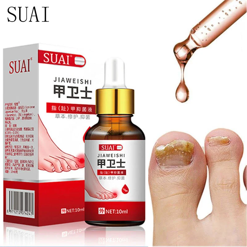P-Beauty Cosmetic Accessories Nagelpilz-Behandlungsstift Anti Nagelpilz Pilz Fusspilz Behandlung Entfernung Nagel Pilz Nailum 1 Tlg S02b20co